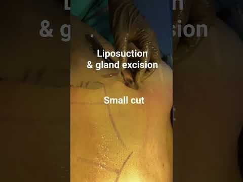 Recent post by Plastic SurgeonVlog