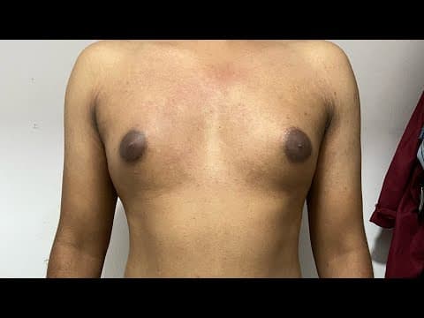 Recent post by Plastic SurgeonVlog