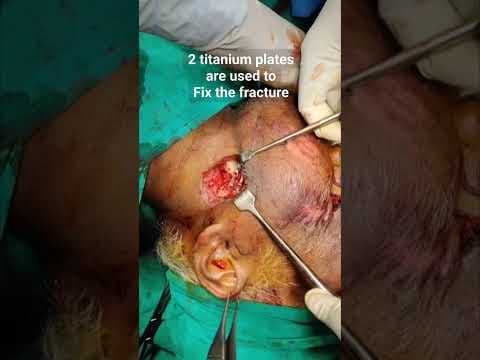 Recent post by Plastic SurgeonVlog