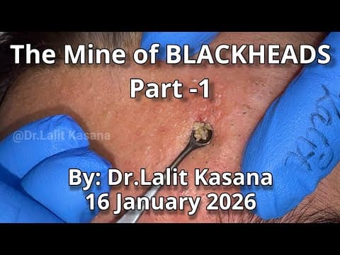 Recent post by Dr. Lalit Kasana - Skin Treatment