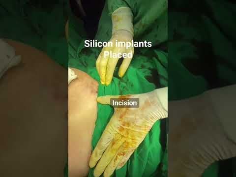 Recent post by Plastic SurgeonVlog