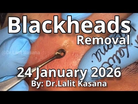 Recent post by Dr. Lalit Kasana - Skin Treatment