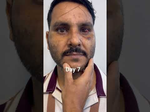 Recent post by Plastic SurgeonVlog