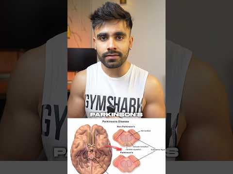 Recent post by Ekansh Taneja