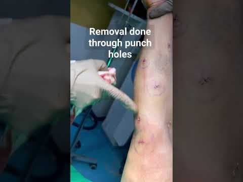 Recent post by Plastic SurgeonVlog