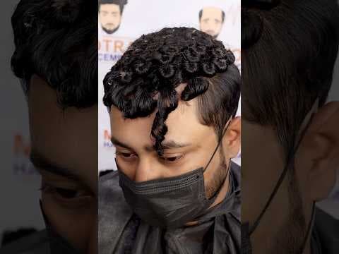 Recent post by Malhotra Hair Replacement