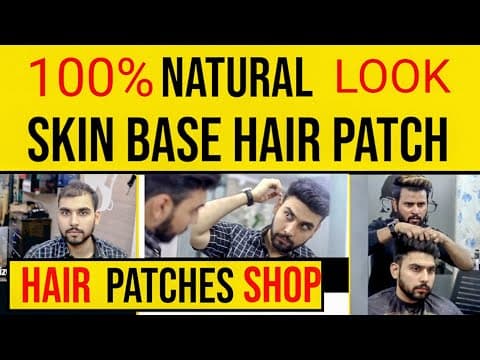 Recent post by RIZY HAIR SOLUTION,Hair Patch Center in Delhi