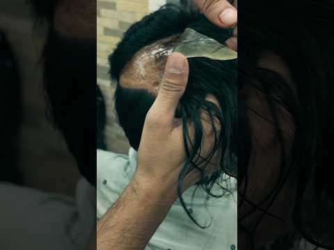 Recent post by RIZY HAIR SOLUTION,Hair Patch Center in Delhi