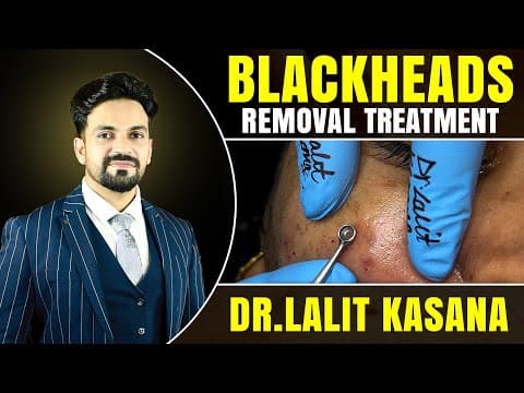 Recent post by Dr. Lalit Kasana - Skin Treatment