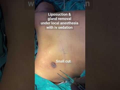 Recent post by Plastic SurgeonVlog