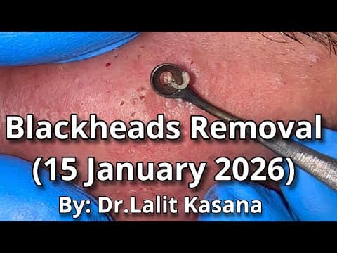 Recent post by Dr. Lalit Kasana - Skin Treatment