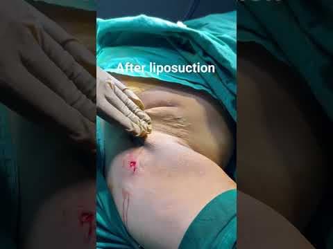 Recent post by Plastic SurgeonVlog