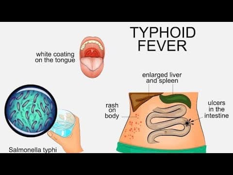 Recent post by Ayurved health