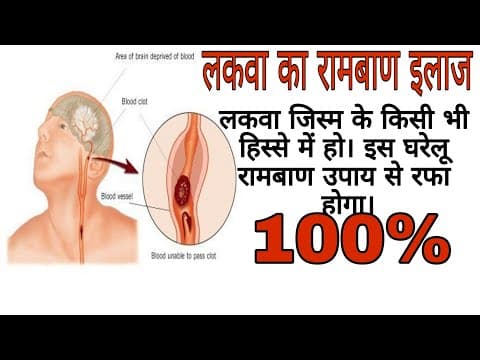 Recent post by Ayurved health