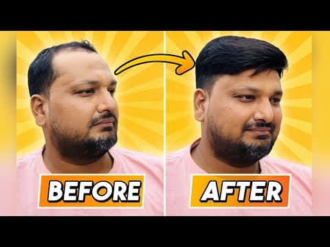 Recent post by RIZY HAIR SOLUTION,Hair Patch Center in Delhi