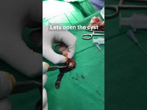 Recent post by Plastic SurgeonVlog