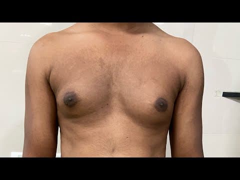 Recent post by Plastic SurgeonVlog