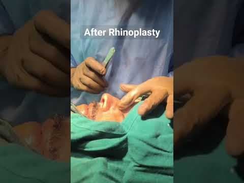 Recent post by Plastic SurgeonVlog
