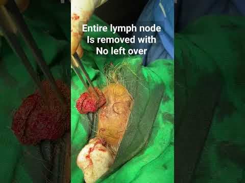 Recent post by Plastic SurgeonVlog