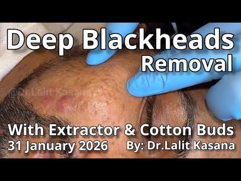 Recent post by Dr. Lalit Kasana - Skin Treatment