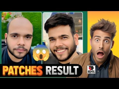 Recent post by RIZY HAIR SOLUTION,Hair Patch Center in Delhi