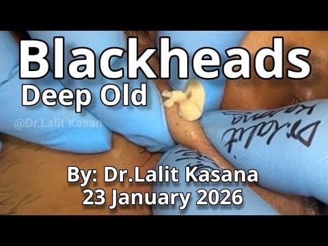 Recent post by Dr. Lalit Kasana - Skin Treatment