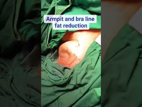 Recent post by Plastic SurgeonVlog