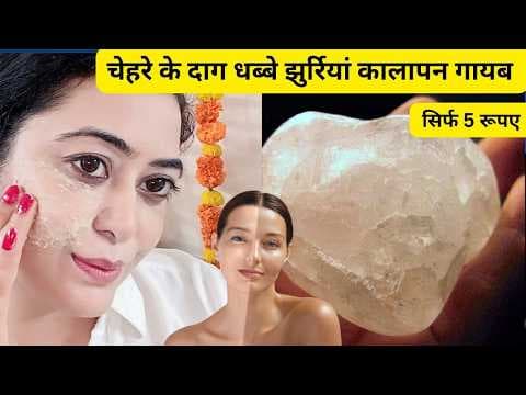 Recent post by Pooja Luthra
