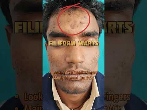 Recent post by Dr. Rishab Mahajan