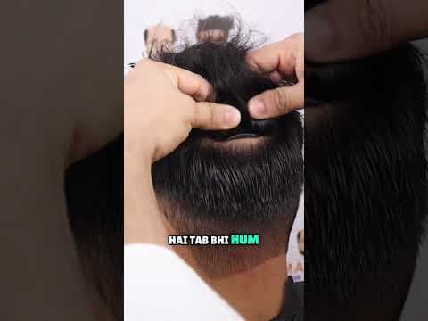 Recent post by Malhotra Hair Replacement