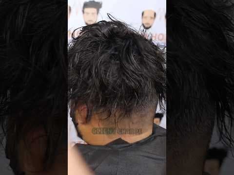 Recent post by Malhotra Hair Replacement