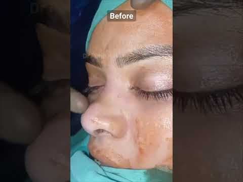 Recent post by Plastic SurgeonVlog