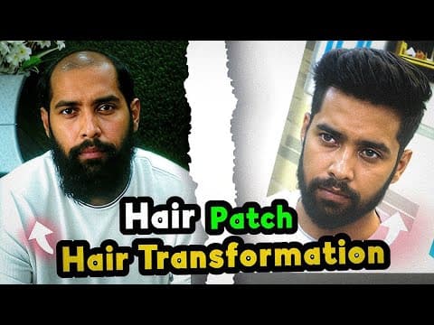 Recent post by RIZY HAIR SOLUTION,Hair Patch Center in Delhi
