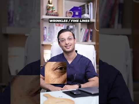 Recent post by Dr. Sarin 