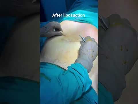 Recent post by Plastic SurgeonVlog