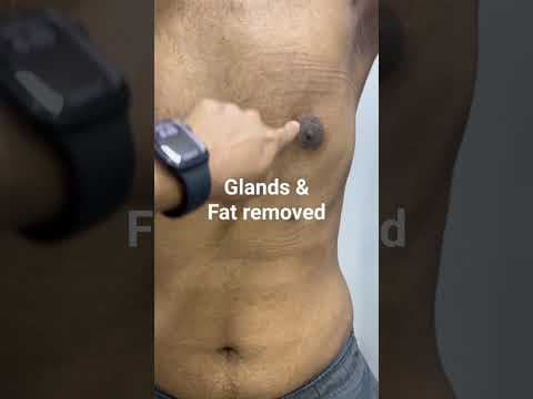 Recent post by Plastic SurgeonVlog