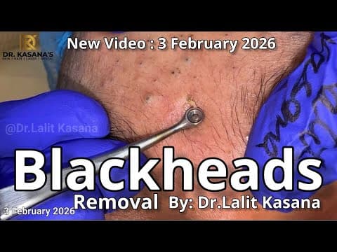 Recent post by Dr. Lalit Kasana - Skin Treatment