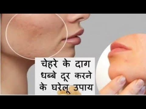 Recent post by Gharelu nuskhe asardar upay