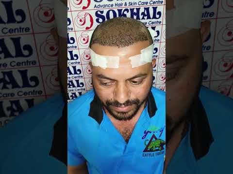 Recent post by Dr.Rajesh sokhal