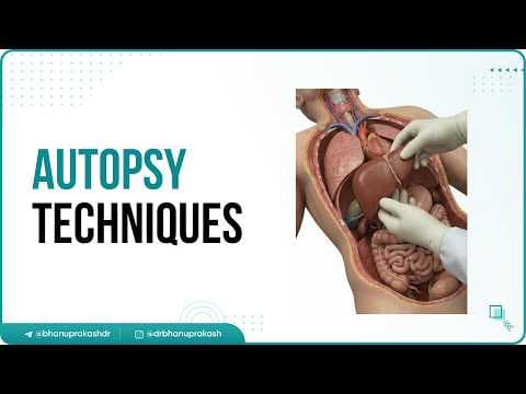 Recent post by Dr.G Bhanu Prakash Animated Medical Videos