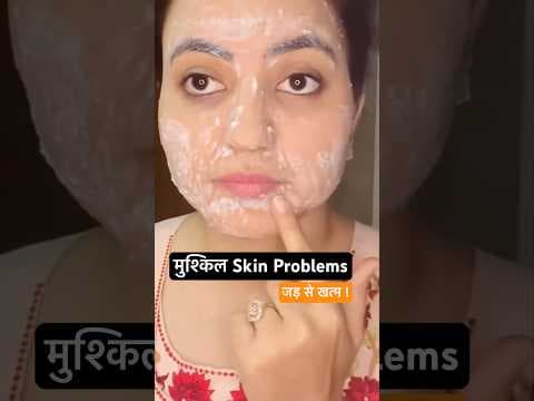Recent post by Preity प्रेरणा