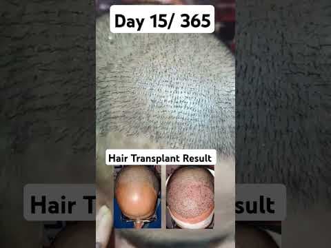 Recent post by Dr.Rajesh sokhal