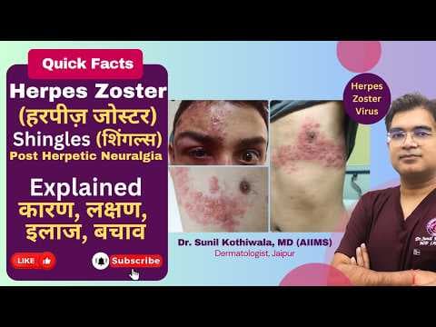 Recent post by SkinEva Clinic Dr. Sunil Kothiwala