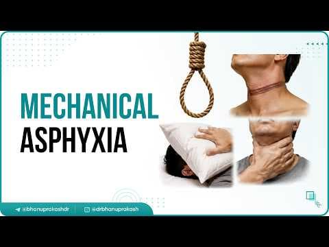 Recent post by Dr.G Bhanu Prakash Animated Medical Videos