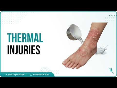 Recent post by Dr.G Bhanu Prakash Animated Medical Videos