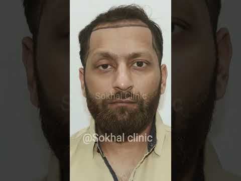 Recent post by Dr.Rajesh sokhal