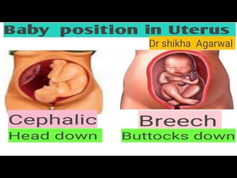 Recent post by Dr Shikha Agarwal