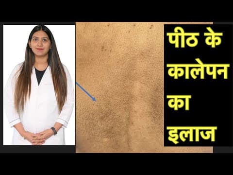 Recent post by Dr Khushboo’s health channel