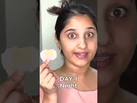 Recent post by Meghana Lokesh