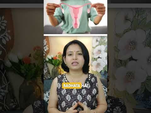 Recent post by Vaishali Patil